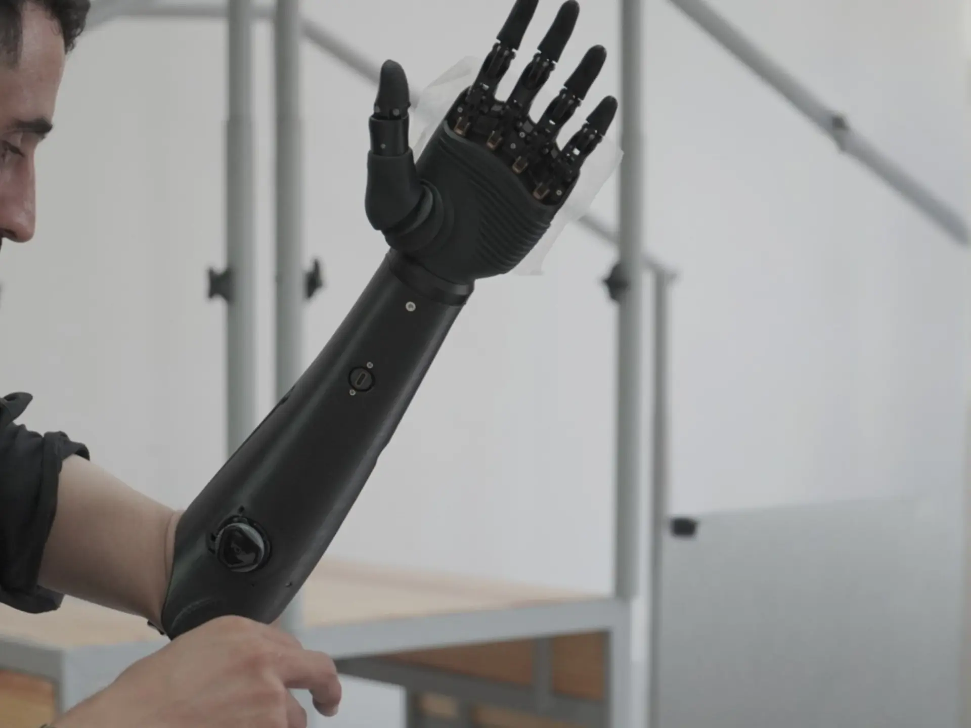 OHAND bionic prosthetic hand with articulated black fingers worn by a patient
