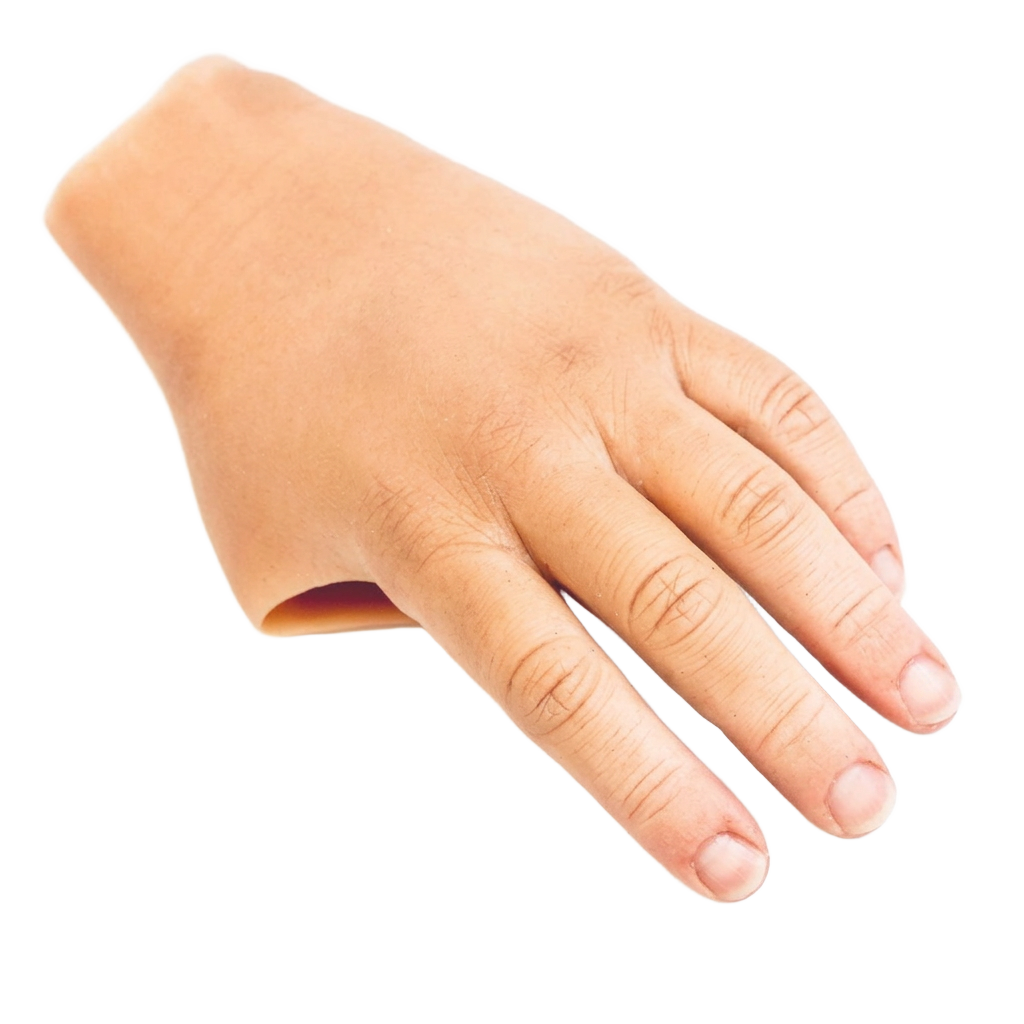 Custom silicone partial hand prosthesis in a natural skin tone